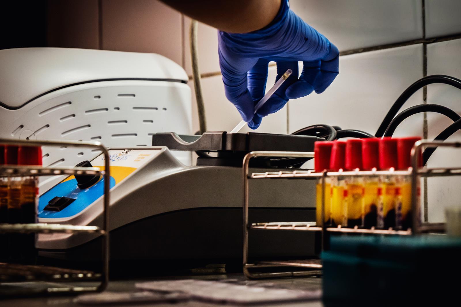 Building laboratory capacity for HIV, Hepatitis &amp; STIs